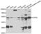 Adenylate Cyclase 1 antibody, orb314825, Biorbyt, Western Blot image 