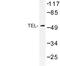 ETS Variant 6 antibody, LS-C176758, Lifespan Biosciences, Western Blot image 