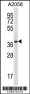 Proteasome Subunit Alpha 1 antibody, 57-838, ProSci, Western Blot image 