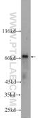 HNF1 Homeobox A antibody, 22426-1-AP, Proteintech Group, Western Blot image 