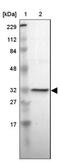 3-Hydroxy-3-Methylglutaryl-CoA Lyase antibody, NBP1-83251, Novus Biologicals, Western Blot image 
