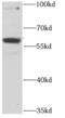 Ribosomal Protein S6 Kinase Like 1 antibody, FNab07483, FineTest, Western Blot image 
