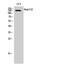 Nucleolar Protein 8 antibody, A10985, Boster Biological Technology, Western Blot image 