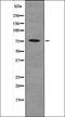 Protein Kinase C Alpha antibody, orb336063, Biorbyt, Western Blot image 