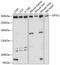 Spectrin Alpha, Erythrocytic 1 antibody, A03376, Boster Biological Technology, Western Blot image 