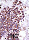 Calcium/Calmodulin Dependent Protein Kinase I antibody, abx033231, Abbexa, Immunohistochemistry paraffin image 