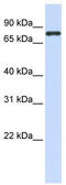 Acid Phosphatase 6, Lysophosphatidic antibody, TA346625, Origene, Western Blot image 