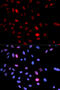 Structural maintenance of chromosomes protein 1A antibody, A02148S957-1, Boster Biological Technology, Western Blot image 