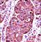 Tyrosinase antibody, LS-C100525, Lifespan Biosciences, Immunohistochemistry paraffin image 