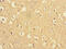 Presenilin 1 antibody, CSB-PA018846EA01HU, Cusabio, Immunohistochemistry frozen image 