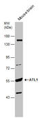 Atlastin GTPase 1 antibody, GTX131075, GeneTex, Western Blot image 