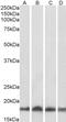 Ubiquitin Conjugating Enzyme E2 L3 antibody, 45-165, ProSci, Western Blot image 