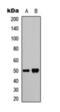 SET And MYND Domain Containing 2 antibody, orb393165, Biorbyt, Western Blot image 