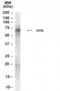 Spleen Associated Tyrosine Kinase antibody, NB100-1796, Novus Biologicals, Western Blot image 