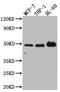 Vitamin D Receptor antibody, CSB-RA945260A0HU, Cusabio, Western Blot image 