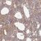 Chaperonin Containing TCP1 Subunit 6A antibody, HPA042996, Atlas Antibodies, Immunohistochemistry paraffin image 