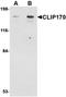 CAP-Gly Domain Containing Linker Protein 1 antibody, orb75014, Biorbyt, Western Blot image 