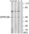 G Protein-Coupled Receptor Class C Group 5 Member B antibody, abx015317, Abbexa, Western Blot image 