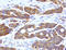 PYM Homolog 1, Exon Junction Complex Associated Factor antibody, LS-C796967, Lifespan Biosciences, Immunohistochemistry paraffin image 
