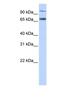 Transporter 1, ATP Binding Cassette Subfamily B Member antibody, ab83817, Abcam, Western Blot image 