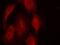 Cyclin Dependent Kinase 6 antibody, 79-431, ProSci, Immunofluorescence image 