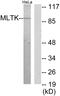 Mitogen-Activated Protein Kinase Kinase Kinase 20 antibody, LS-C119288, Lifespan Biosciences, Western Blot image 