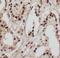 Transcriptional Adaptor 3 antibody, FNab08476, FineTest, Immunohistochemistry paraffin image 