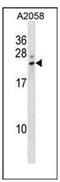 Lipocalin 8 antibody, AP52454PU-N, Origene, Western Blot image 