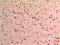 Beclin 1 antibody, GTX34055, GeneTex, Immunohistochemistry paraffin image 