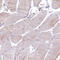 EPS8 Like 2 antibody, HPA041143, Atlas Antibodies, Immunohistochemistry paraffin image 