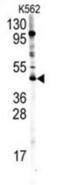 Protein Arginine Methyltransferase 8 antibody, abx026652, Abbexa, Western Blot image 