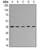 Capping Actin Protein, Gelsolin Like antibody, orb341277, Biorbyt, Western Blot image 