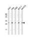 Cyclin Dependent Kinase 4 antibody, M00159-2, Boster Biological Technology, Western Blot image 