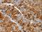 Aldolase, Fructose-Bisphosphate B antibody, LS-C406115, Lifespan Biosciences, Immunohistochemistry paraffin image 