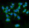 Mitochondrial Antiviral Signaling Protein antibody, A00169-3, Boster Biological Technology, Immunofluorescence image 