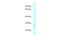 Charged Multivesicular Body Protein 2A antibody, PA5-70553, Invitrogen Antibodies, Western Blot image 