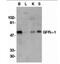 GDNF Family Receptor Alpha 1 antibody, NBP1-77043, Novus Biologicals, Western Blot image 