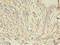 Junction Plakoglobin antibody, LS-C370768, Lifespan Biosciences, Immunohistochemistry paraffin image 