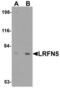 Leucine Rich Repeat And Fibronectin Type III Domain Containing 5 antibody, TA306744, Origene, Western Blot image 