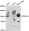 Fc Fragment Of IgG Receptor IIa antibody, abx001215, Abbexa, Western Blot image 