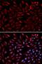 Proteasome 26S Subunit, ATPase 2 antibody, LS-C331807, Lifespan Biosciences, Immunofluorescence image 