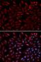 Proteasome 26S Subunit, ATPase 2 antibody, LS-C331807, Lifespan Biosciences, Immunofluorescence image 