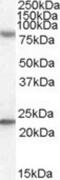 DExH-Box Helicase 58 antibody, NBP1-20939, Novus Biologicals, Western Blot image 