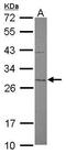 Mitochondrial Translational Initiation Factor 3 antibody, GTX119582, GeneTex, Western Blot image 