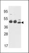 Keratin 18 antibody, LS-B9323, Lifespan Biosciences, Western Blot image 