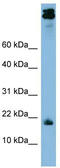 N-Acylsphingosine Amidohydrolase 1 antibody, TA344619, Origene, Western Blot image 