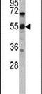 CD36 Molecule antibody, PA5-12514, Invitrogen Antibodies, Western Blot image 