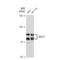 DEAD-Box Helicase 17 antibody, GTX02851, GeneTex, Western Blot image 