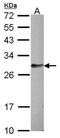 Hypothetical protein LOC159090 antibody, orb74293, Biorbyt, Western Blot image 