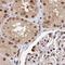 Proteasome 26S Subunit, Non-ATPase 7 antibody, NBP2-38780, Novus Biologicals, Immunohistochemistry paraffin image 